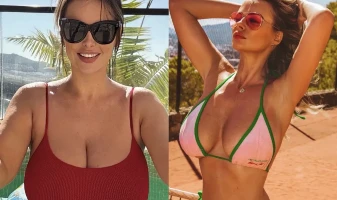 Rhian Sugden Breast Reduction